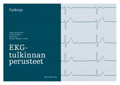 EKG-tulkinnan perusteet